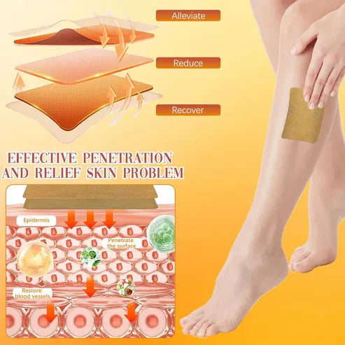 🌿 Prírodná bylinná terapia 🦵 Pre pavúčie a kŕčové žily, opuchy nôh, únavu a celkové zdravie žíl