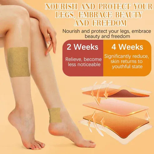 🌿 Prírodná bylinná terapia 🦵 Pre pavúčie a kŕčové žily, opuchy nôh, únavu a celkové zdravie žíl